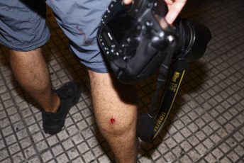 Buenos Aires, Argentina.- En las fotos tomadas el 1 de febrero del 2024, nuevos enfrentamientos entre policías y manifestantes se produjeron a las afueras del Congreso durante el debate en la Cámara de Diputados de la denominada ley Bases, lo que llevó a legisladores del kirchnerismo y la izquierda a presentar una moción para suspender la sesión, lo que fue rechazado por la mayoría del cuerpo legislativo.